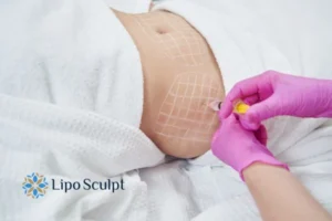 Are The Results From Aqualyx Permanent? 1 Do you want to know how long Aqualyx Enderby results last?